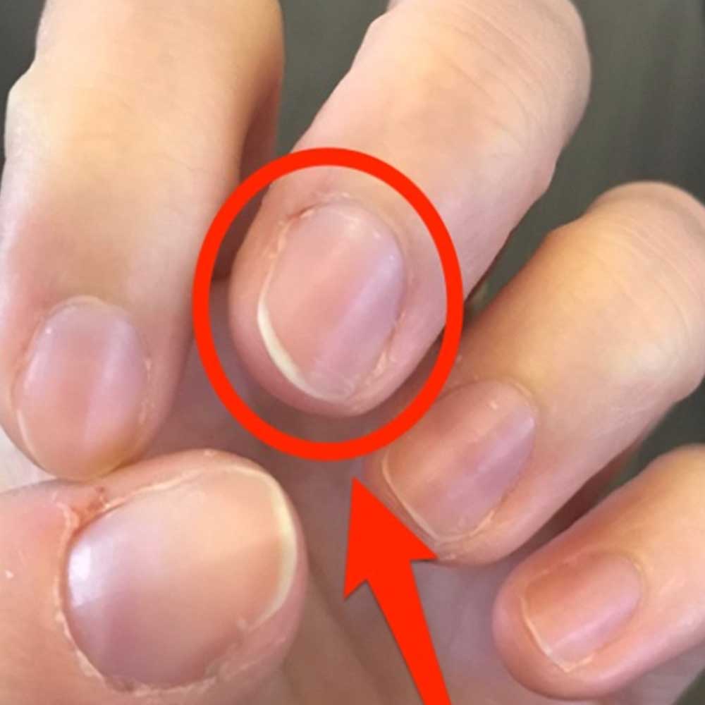 Diabetes Symptoms: These symptoms appear in the legs when the blood sugar rises, get a diabetes test done immediately